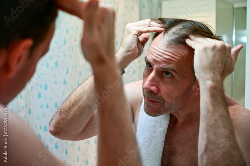 Photography man with hair loss problem looking in mirror at home