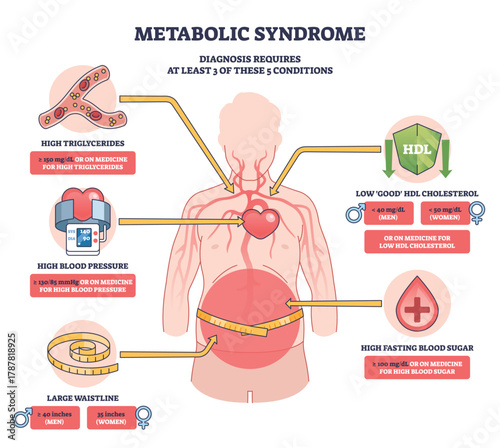 Metabolic syndrome outline visualizes core risks, large waist, heart, and blood drop depict obesity, hypertension, lipids, and glucose markers in a clear medical schema. Outline diagram