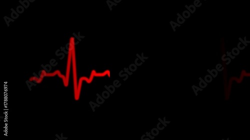 Cardiogram cardiograph oscilloscope screen abstract, animation.Ekg Or Ecg Looping background. 4K video