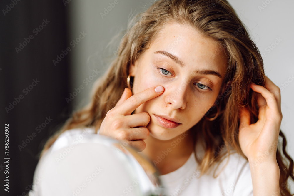 Fototapeta premium Close-up of young woman carefully examining skin in small mirror. Beautiful woman with acne touches face in cozy room. Concept of naturalness and beauty, dermatology. Acne.