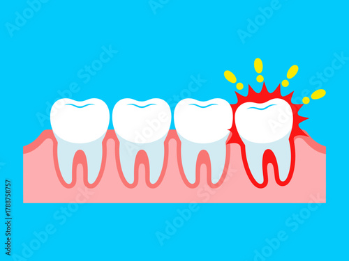 This educational image illustrates healthy teeth alongside an inflamed gum with a pain indicator, emphasizing the importance of dental health and oral hygiene.