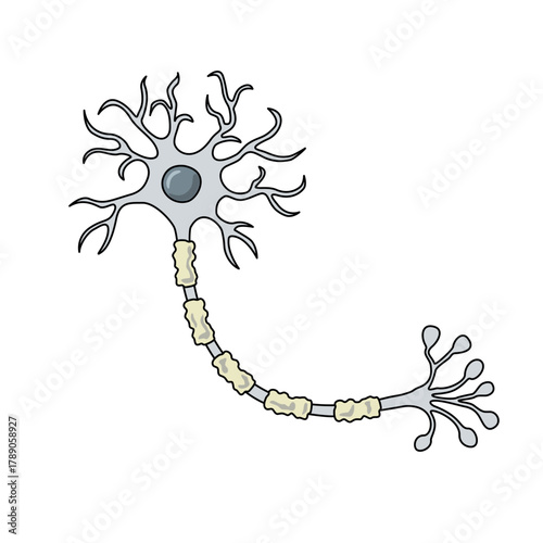 Illustration of peripheral neuropathy cell structure, damaged myelin sheath. Impaired signal transmission, pain, and weakness. Unhealthy myelin sheath, vector illustration for medical, poster elements