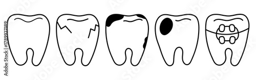 Doodle icon set with tooth states, healthy, cracked, decayed, filled, braces. Ideal for dental clinic brochures, health education materials, medical presentations, patient information leaflets