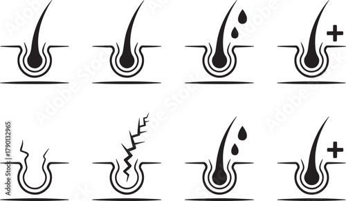 Hair follicle problems and solutions