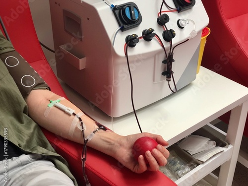 A close-up of an arm with an IV, connected to an apheresis machine for blood plasma donation. The donor is squeezing a red ball, medical procedure and act of giving.