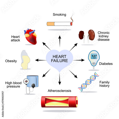 Risk factors of heart failure. Heart Attack.