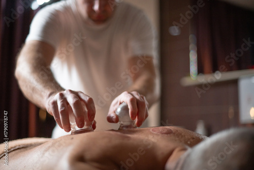 Close up of therapist applying cupping therapy on male clients back during wellness and rehabilitation treatment, traditional alternative medicine for relaxation and pain relief.