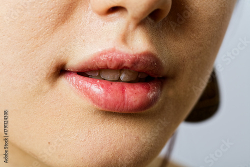 Person Smiling with Natural White Teeth Close-Up