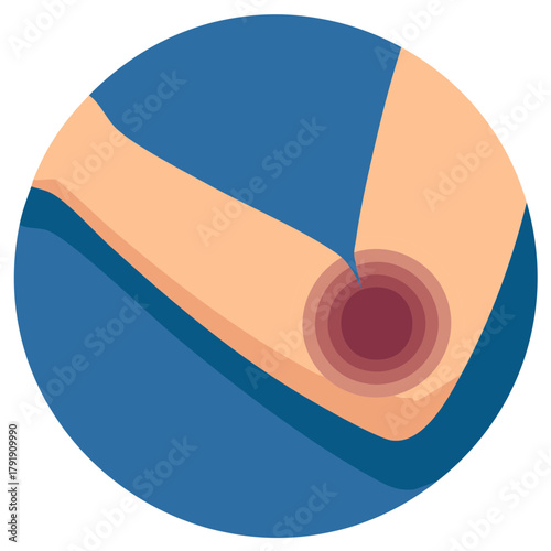 Elbow Pain Illustration: Medical Concept of Injury or Discomfort