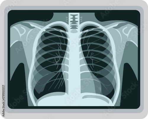 Medical vector illustration of a human chest X-ray showing lungs and rib cage for diagnostic purposes