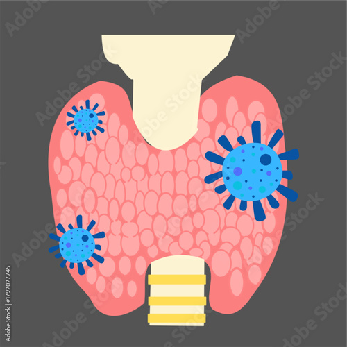 thyroid infection thyroiditis thyroid gland inflammation endocrine  thyroid hormone.eps