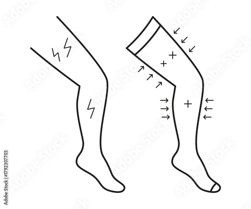 Pain in leg and compression stocking, socks on leg with arrows pressure, line icon. Treatment varicose veins on foot. Medical therapy, rehabilitation clothes. Vector linear illustration