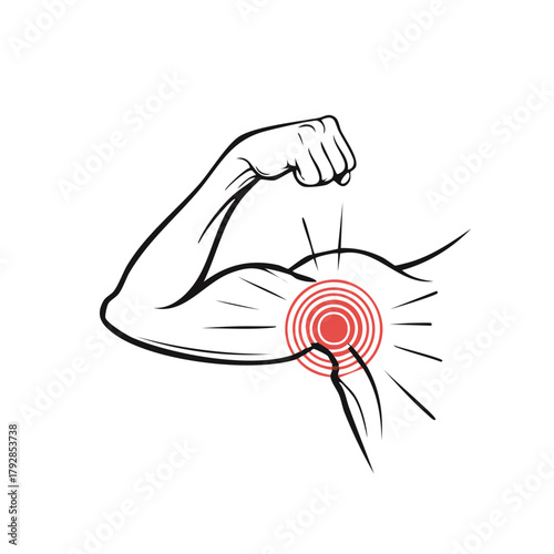 Stylized Bicep Muscle Flexing with a Red Concentric Pain Indicator