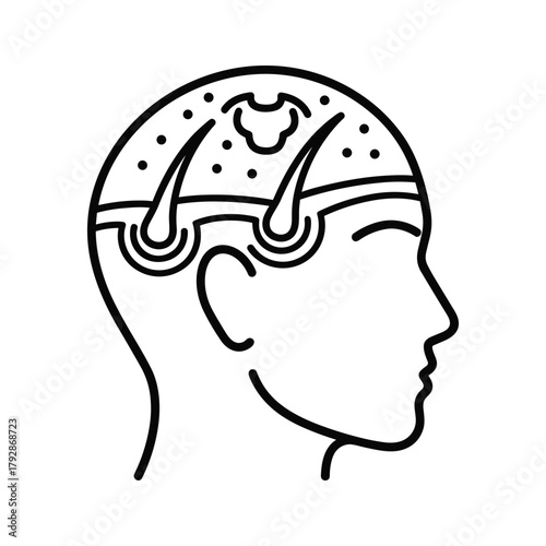 Outline of a human head showing hair follicles and scalp structure
