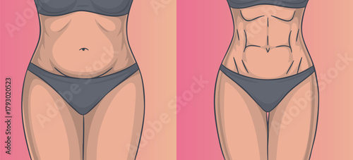 Vector illustration Before and after weight loss. Woman before and after diet and fitness. Weight loss concept.