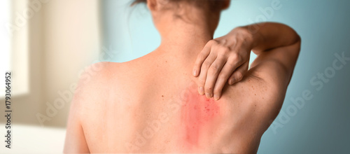 Young woman scratching her red, irritated back during a medical consultation. Close-up of skin redness and irritation, possibly caused by itching or dermatological condition. Patient at doctor’s offic