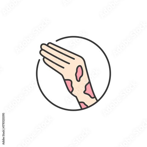 Rash icon for skincare logo design—ideal for irritation relief visuals, redness treatment branding, or sensitive skin product packaging. Signals flare-ups, discomfort, and care solutions.