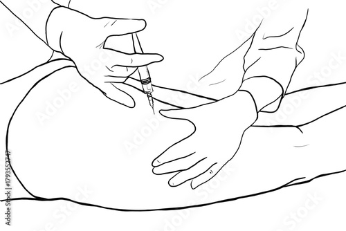 Body part of a person lying face down receiving mesotherapy treatment on the buttocks
