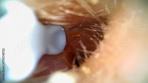 Medical otoscope is providing a close up view of an ear canal with earwax and fine hairs, highlighting potential ear health issues