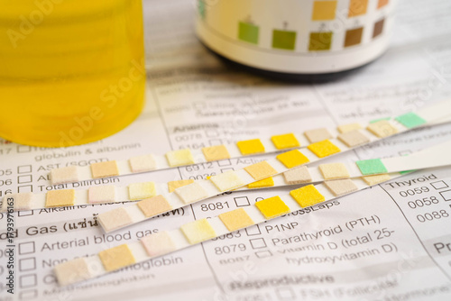 Urinalysis, urine cup with reagent strip pH paper test and comparison chart in laboratory.