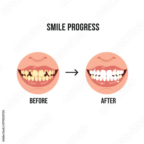 Teeth whitening progress chart showing a smile's transformation from yellow and stained to sparkling white, before and after.