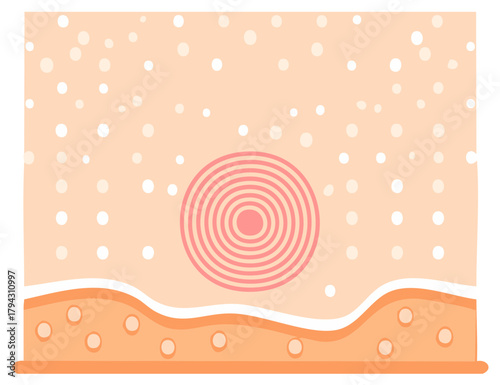 Illustration of skin layers with irritation and pores, soft focus abstract background