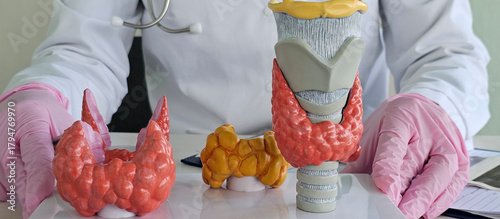 Doctor with human thyroid anatomy model. Thyroid tumor and cancer, postpartum period, papillary carcinoma