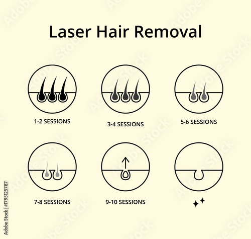 Laser hair removal growth cycle illustration