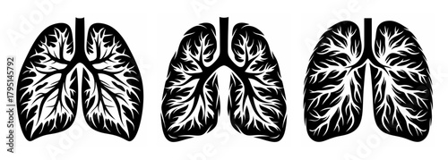 Detailed anatomical representations of human lungs showcasing intricate branching bronchial airways and alveolar structures in a trio.