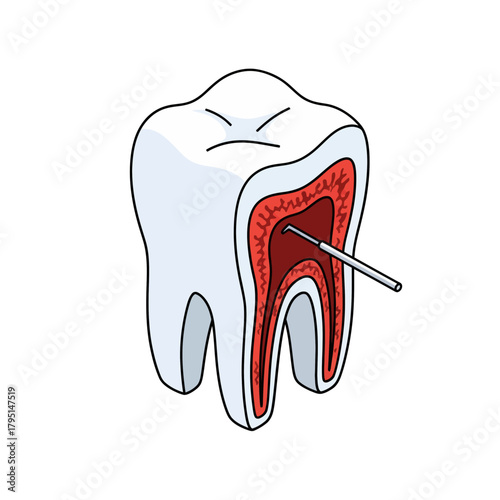 Dental health icon Cartoon vector sticker showing root canal treatment process