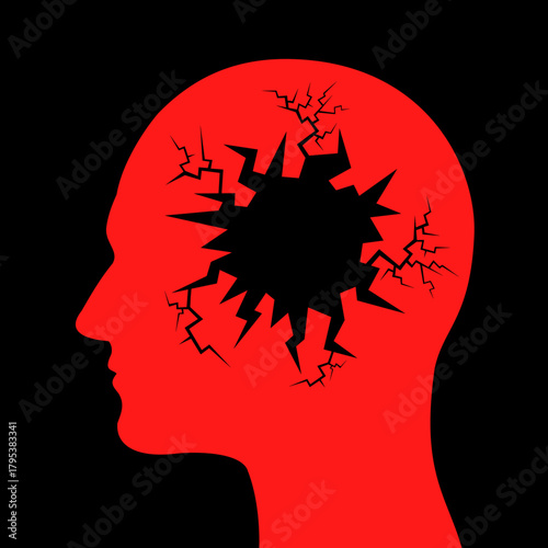 Broken brain as poor mental health and mental disorder - degradation, worsening and deterioration of human head because of depression, dementia, alzheimer, nervous breakdown. Vector illustration.