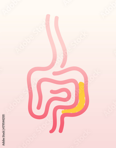 Healthcare vector illustration about colitis and flatulence.