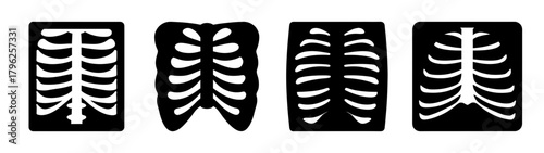 Four chest x-ray images showing rib cage anatomy medical imaging samples