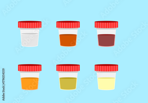urine color test on background and color of urine tell the health of human 