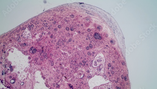 Paraffin-Embedded Tissue Sa...