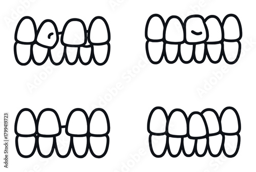 Cartoon teeth diagram showing different tooth conditions and patterns