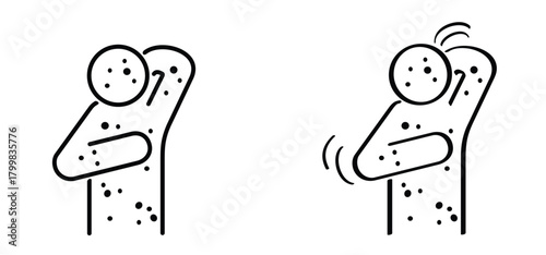 Skin rash, measles on face. Red rash on the body. A sign of measles, lupus, herpes, or rubella, and other autoimmune diseases. Rubeola or morbilli symptom. food allergy. Red spots on body. Itchy skin.