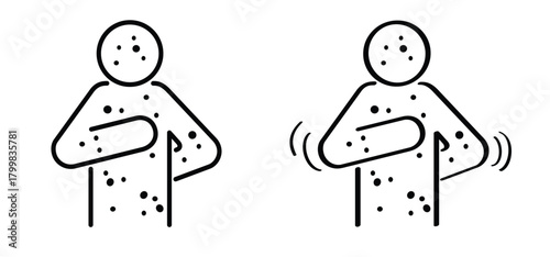 Skin rash, measles on face. Red rash on the body. A sign of measles, lupus, herpes, or rubella, and other autoimmune diseases. Rubeola or morbilli symptom. food allergy. Red spots on body. Itchy skin.