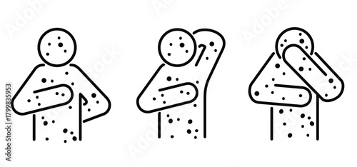Skin rash, measles on face. Red rash on the body. A sign of measles, lupus, herpes, or rubella, and other autoimmune diseases. Rubeola or morbilli symptom. food allergy. Red spots on body. Itchy skin.