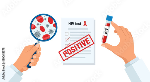 HIV Diagnosis with Positive Stamp on Clipboard