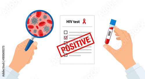 Positive HIV Test Result on Medical Report