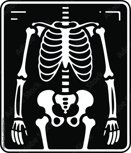 White human skeleton vector X-ray graphic depicting bones of the upper body on a dark background.