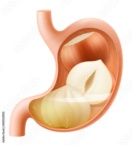 Human Stomach with hazelnuts. The stomach digests hazelnut. A stomach filled with healthy food with protein. Proper nutrition. Realistic 3d Vector illustration. Food digestion process illustration