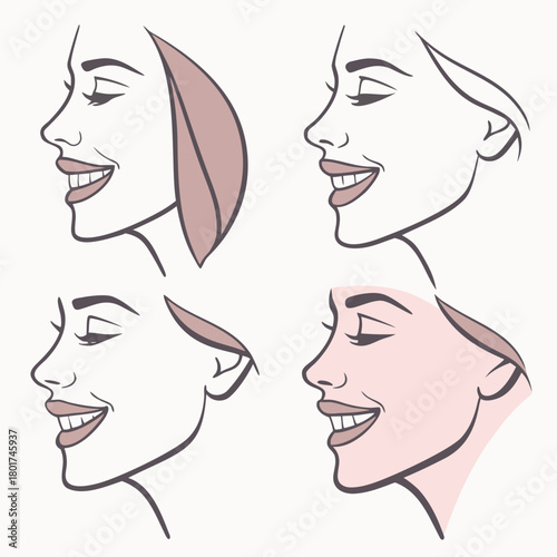Four different face lift procedures
