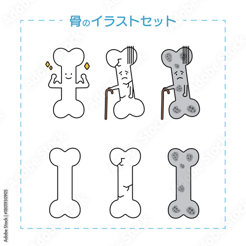 骨の健康状態と骨粗しょう症のイラストセット／かわいい骨キャラクター