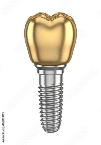 Gold dental implant with metallic abutment isolated on transparent background.