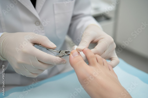 A close-up view of a medical professional, such as a podiatrist or chiropodist, wearing white protective gloves and using stainless steel nippers to carefully trim a patient's toenail.