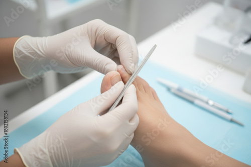 A close-up view of a medical professional, such as a podiatrist or chiropodist, wearing protective gloves and carefully filing a patient's toenails.