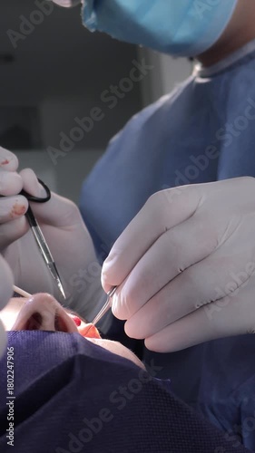 Medical surgeons performing an incision on the upper eyelid during a real blepharoplasty procedure. The image captures the sterile environment, steady hands, and professional technique required in cos