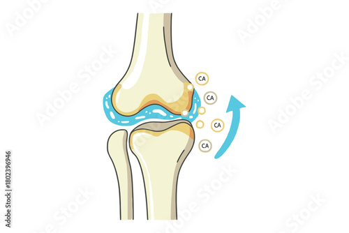 A diagram illustrating the process of calcium deposition within a joint.